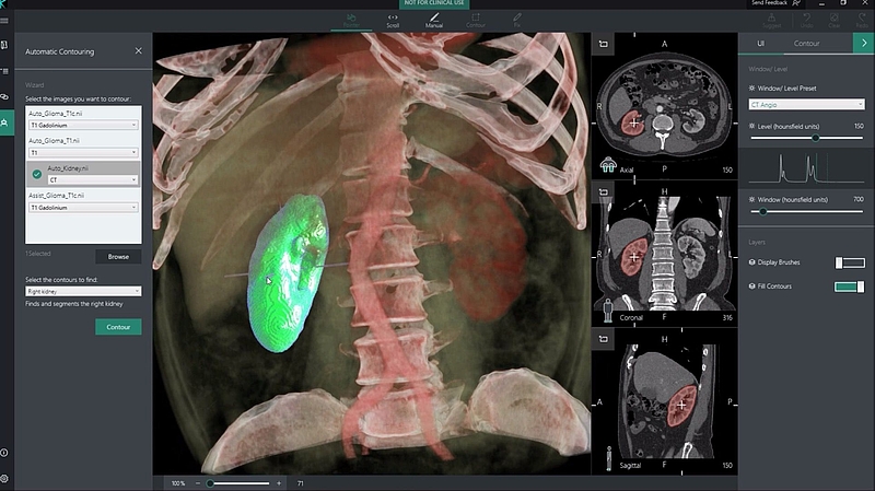 Segmentation Organs Artificial Intelligence