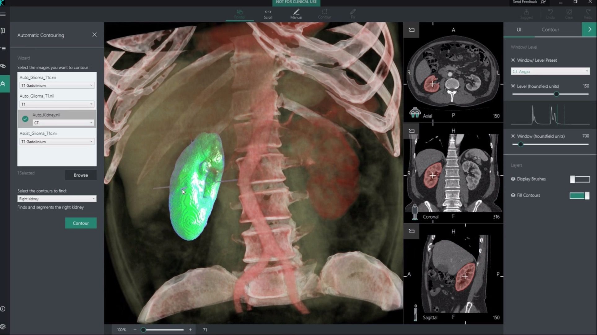 Segmentation Organs Artificial Intelligence